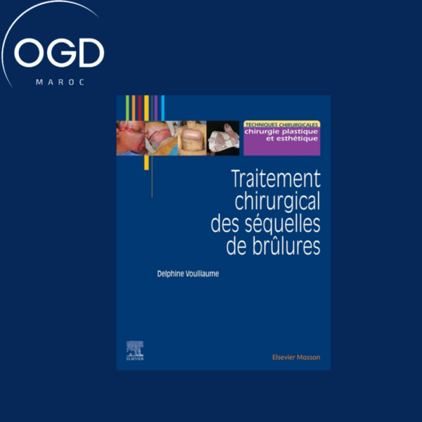 TRAITEMENT CHIRURGICAL DES SEQUELLES DES BRULURES